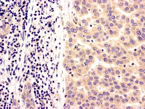 ������֯��ѧȾɫ(�����黯)