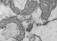 ����ѪҺ����ʶ����֢��Σ��COVID-19����